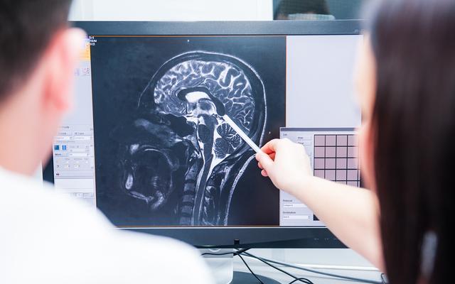 Ärzte diskutieren ein MRI (Symbolbild)