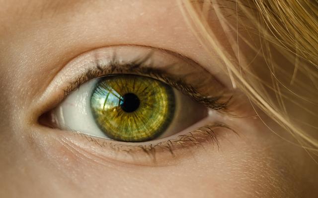 Vision